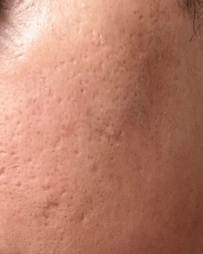 Before image